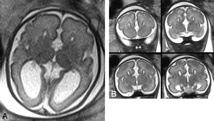 Fig 2.