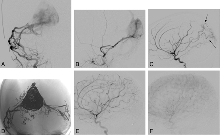 Fig 2.