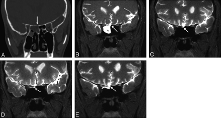 Fig 5.