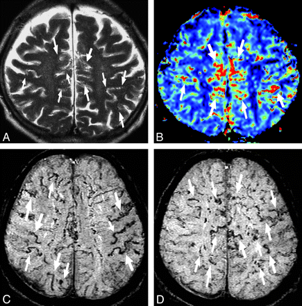 Fig 3.