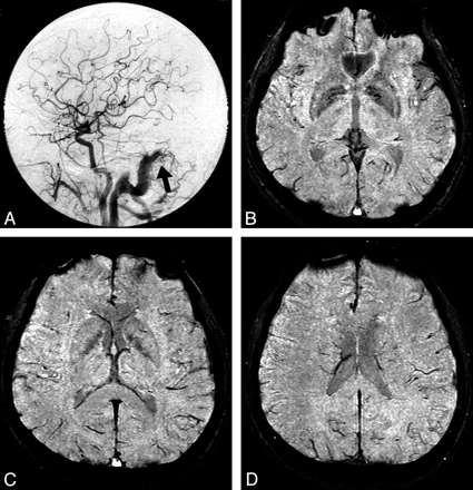 Fig 4.