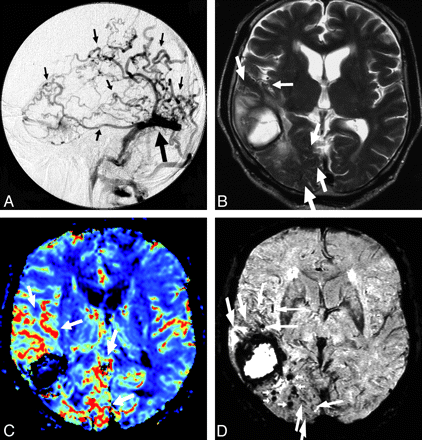 Fig 5.