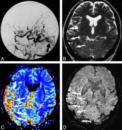 Fig 6.