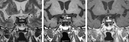 Fig 2.