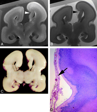 Fig 4.