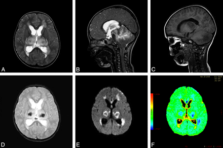 Fig 2.