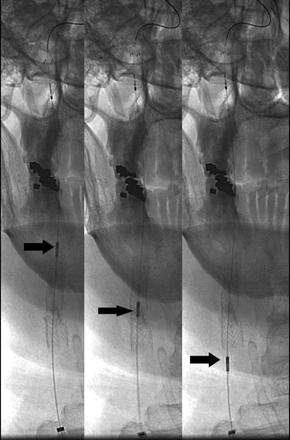 Fig 4.