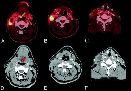 Fig 2.