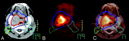 Fig 6.