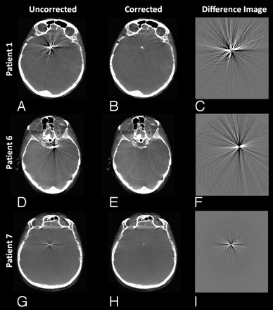 Fig 4.