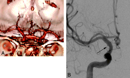 Fig 5.