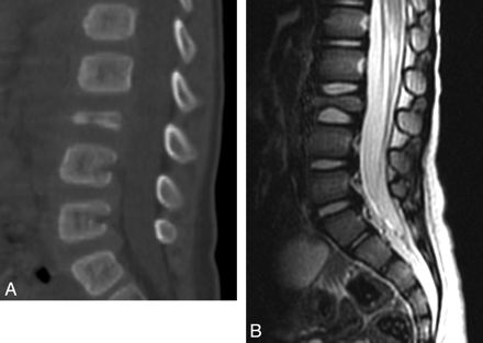 Fig 10.