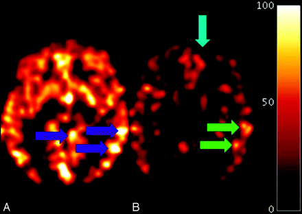 Fig 2.