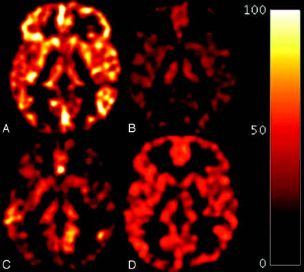 Fig 3.