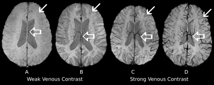 Fig 1.