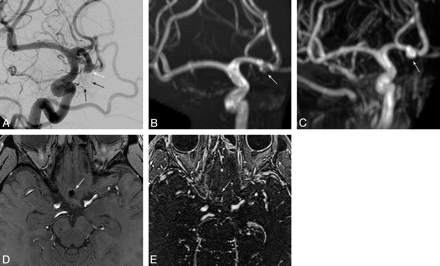 Fig 3.