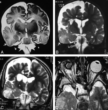 Fig 3.