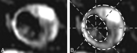 Fig 1.