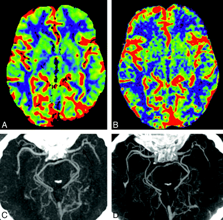 Fig 2.