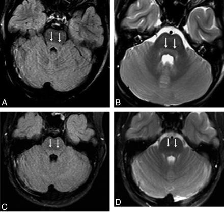 Fig 3.