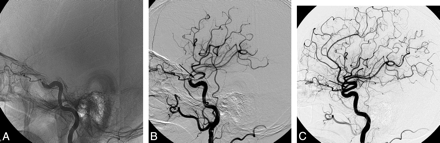 Fig 2.