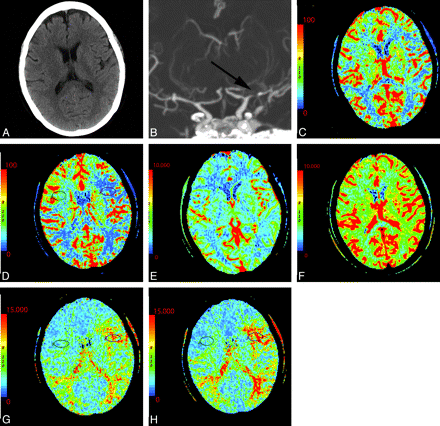 Fig 13.