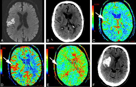 Fig 4.