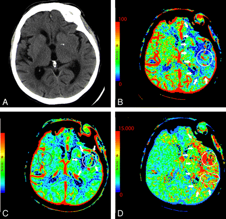 Fig 5.