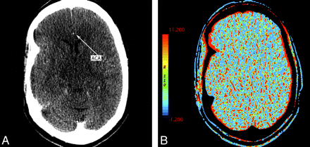 Fig 8.