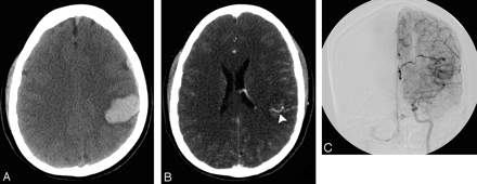 Fig 4.