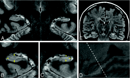 Fig 2.