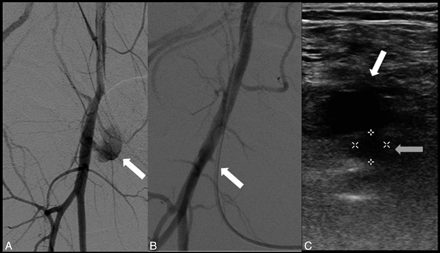 Fig 3.