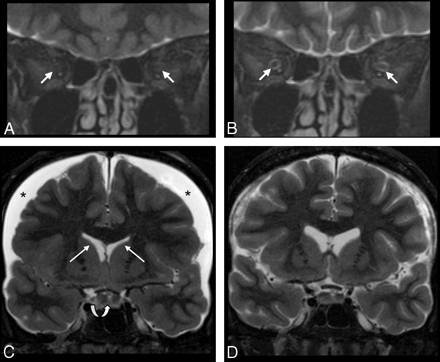 Fig 2.