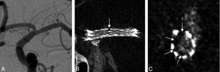 Fig 4.