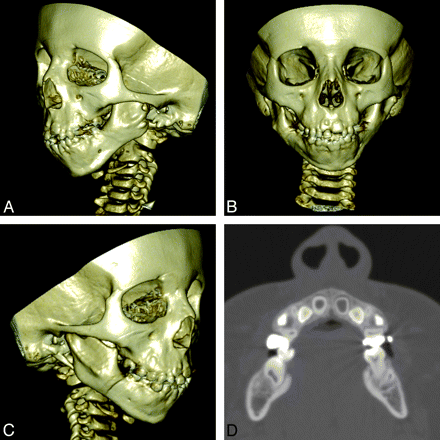 Fig 6.