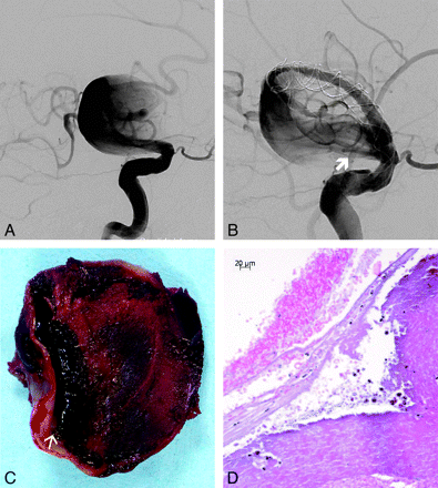 Fig 3.