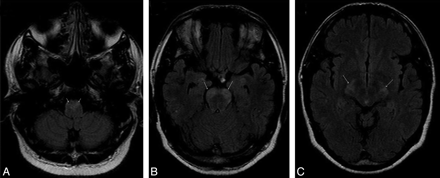 Fig 2.