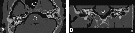 Fig 1.