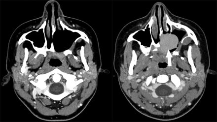 Fig 6.