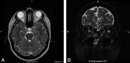 Fig 4.