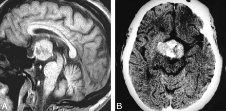 Fig 3.