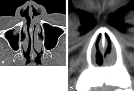 Fig 2.