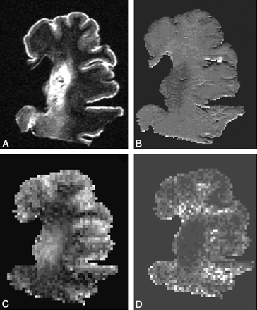 Fig 2.