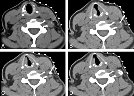 Fig 1.