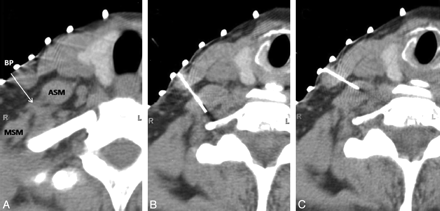 Fig 3.