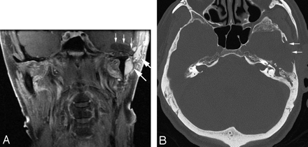 Fig 3.