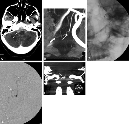 Fig 2.