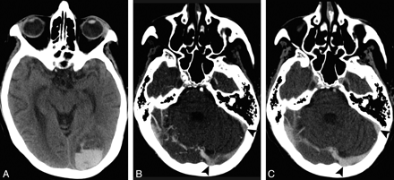 Fig 1.