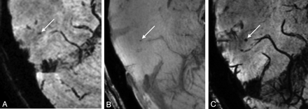 Fig 2.