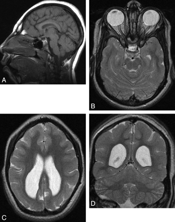 Fig 2.